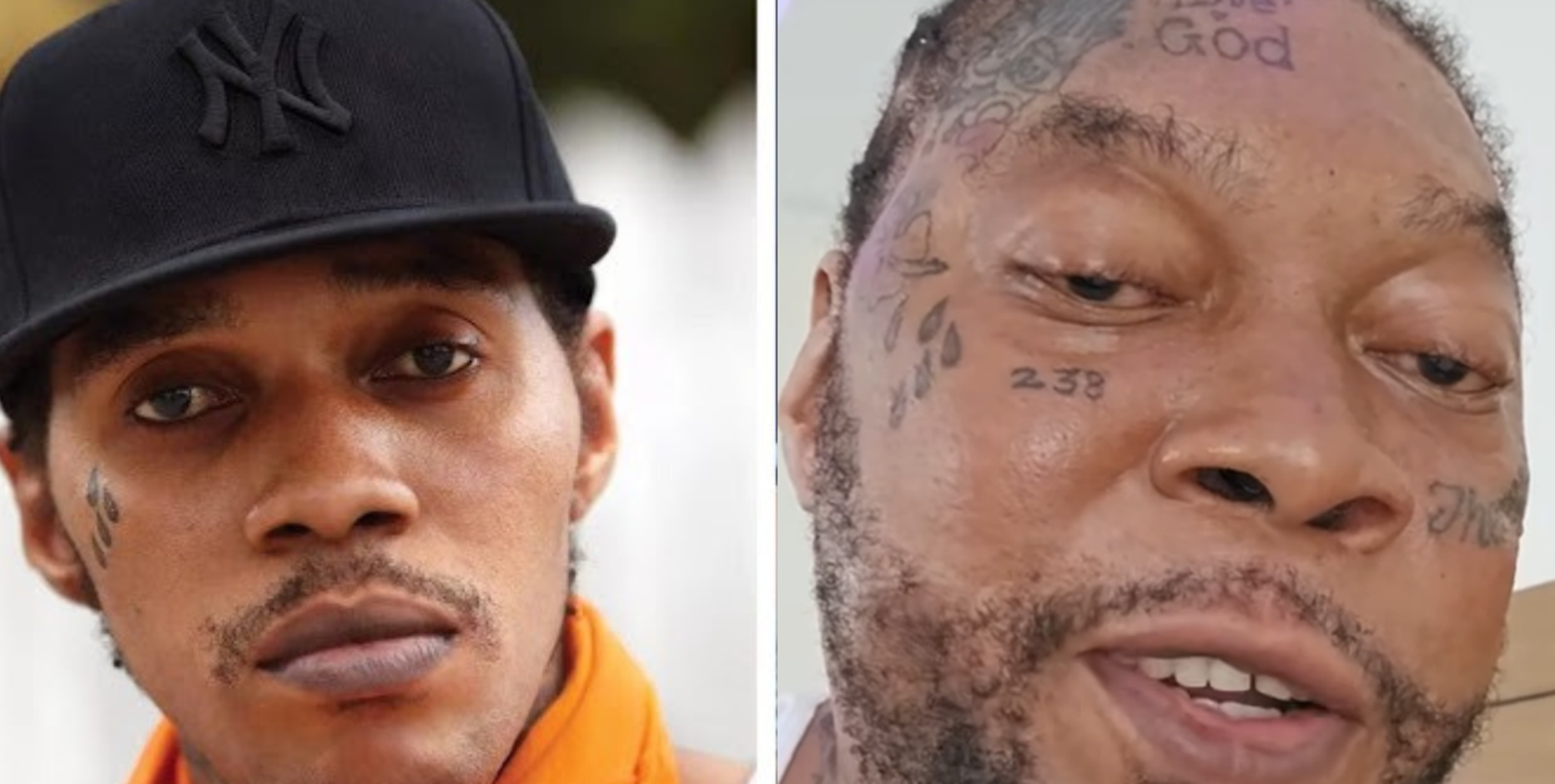 'What happened to Vybz Kartel's face?' Fans question appearance amid battle with Graves'